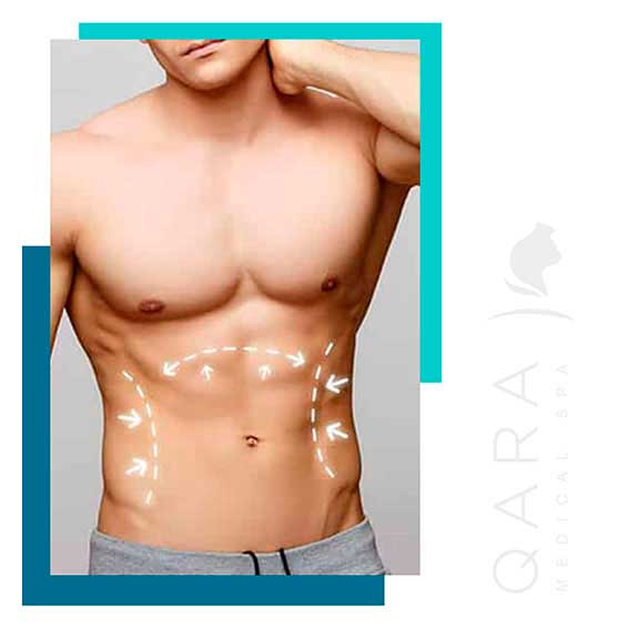QARA for Men Medical SPA