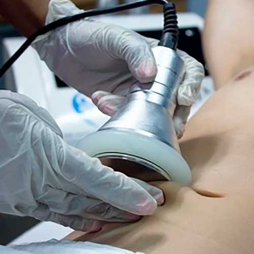 Ultracavitacion hombres