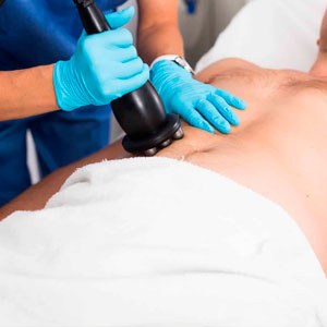 Ultracavitacion hombres