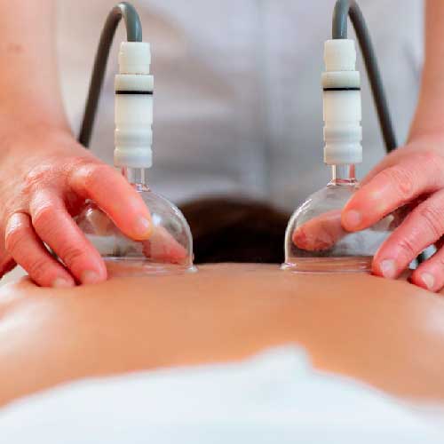 vacumterapia hombres